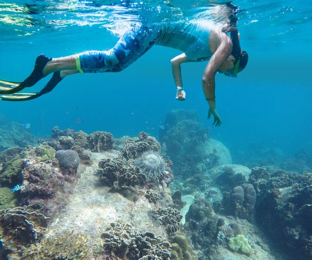 activity_detail_image