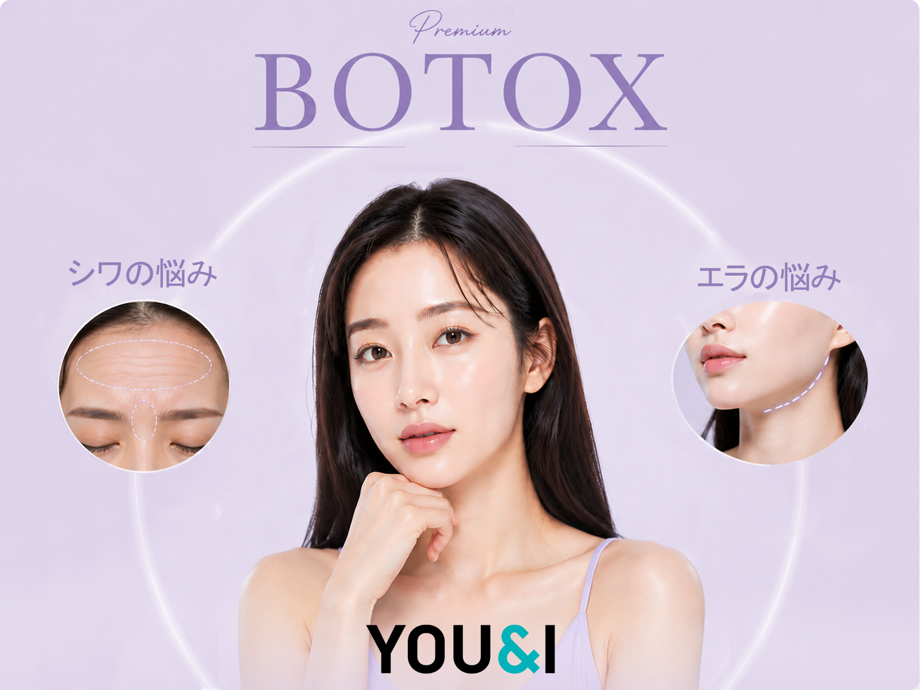 [YOU&I美容クリニック 江南店] ボトックス｜しわボトックス・エラボトックス